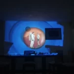 MAGICTOR HY300 Smart Projector